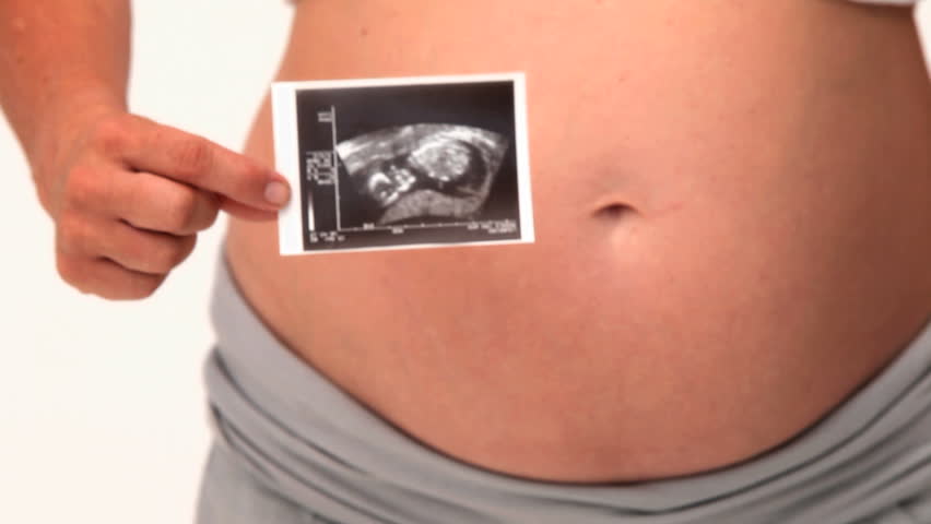 Pregnant woman holding a scan of her future baby against a white background