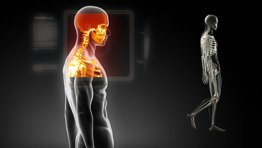 Good posture concept  x-ray spine scan