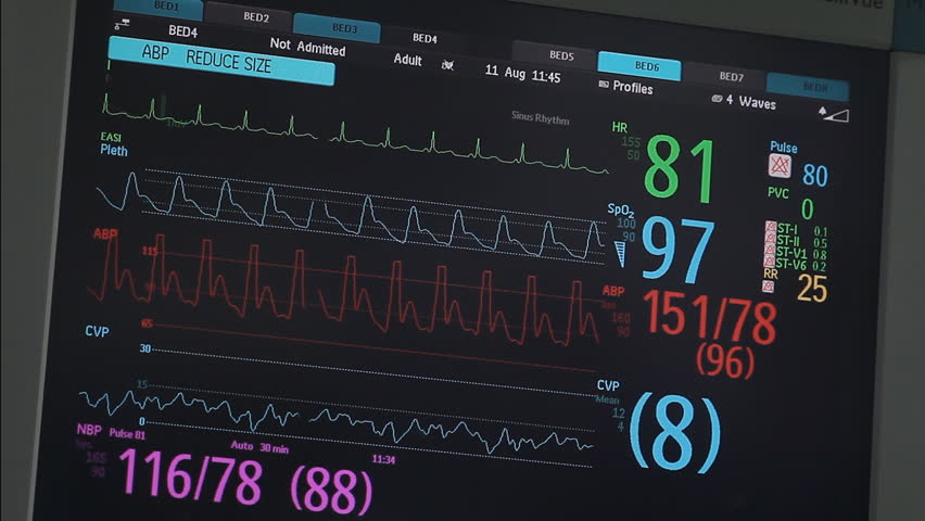 how-to-read-about-patient-vital-signs-monitor-rooemed