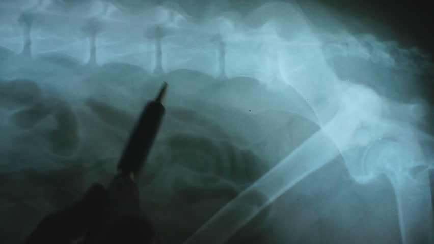 Veterinarian points out arthritic change in the Lumbar spine of a dog radiograph. Minor changes at L5-L6, Major changes at L7-S1. Often a result of Lumbosacral instability.