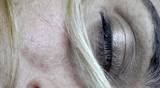 female overdosed 