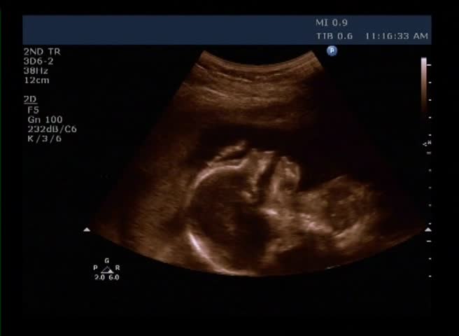 Baby ultrasound scan