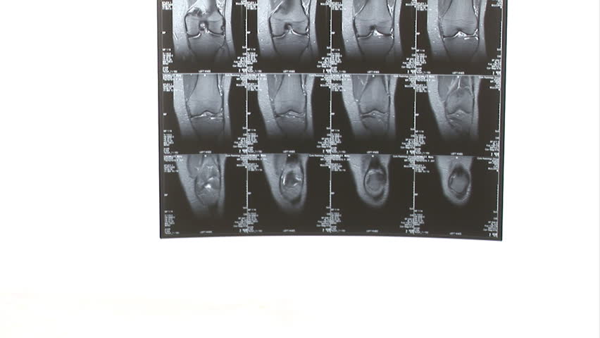 Examining an MRI Scan