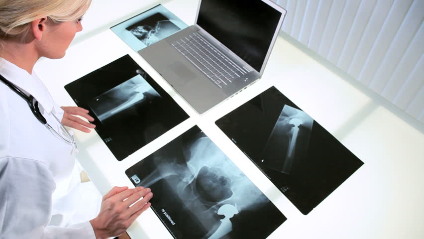 Young female doctor working in radiology department with x-ray films and computer technology