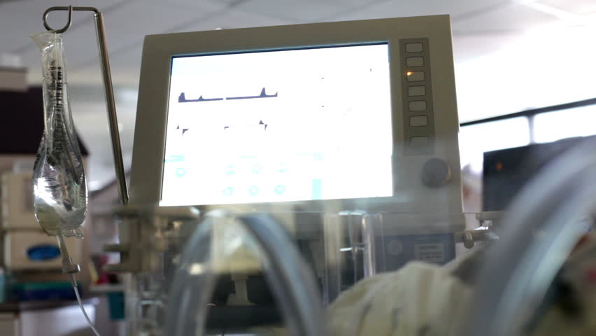 Baby hooked up to heart monitor in hospital