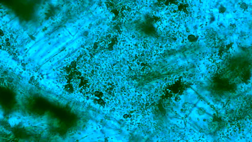 Decomposing Flesh on Microscope 800x (HD). Rotting flesh seen on a microscope under a blue contrast filter. Thousands of bacteria including staph decompose an infection skin sample. 800x magnification
