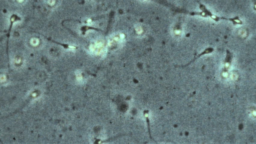 Microscopic Sperm Footage 4