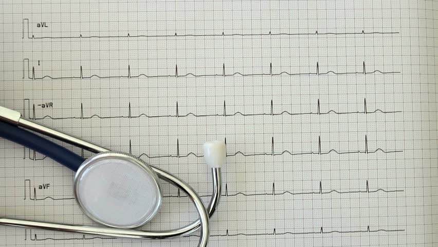 Stethoscope denotes part of exam, along with EKG readout. 1080p