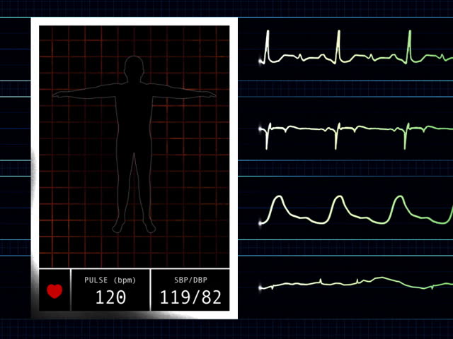 Heart Rate Monitor graphic  PAL video