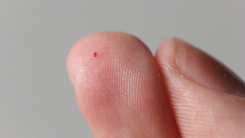 Squeeze out a blood drop from a finger