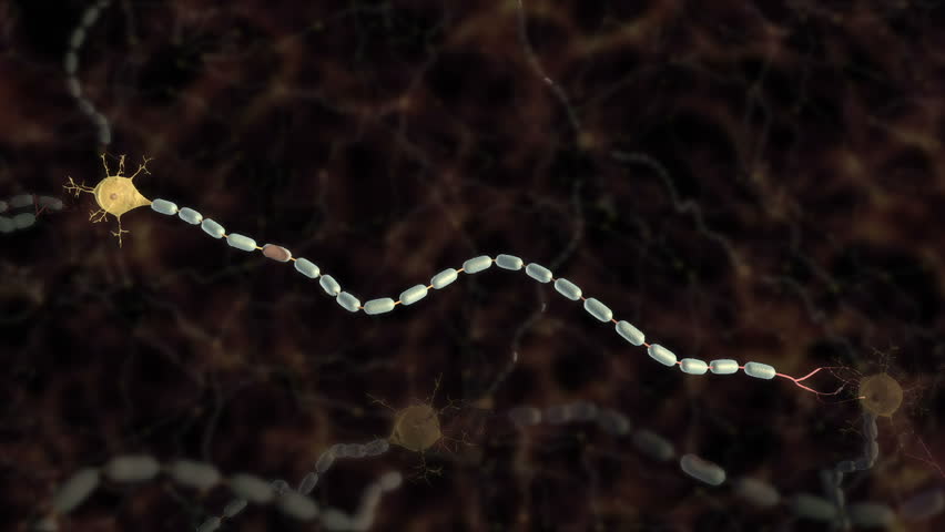 3D animation with damage caused by multiple sclerosis disrupting action potential conduction down axon slowing neurotransmission between neurons