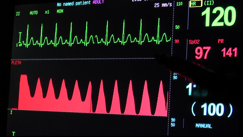 Physician points out heart EKG, respiration measurements displayed on vital signs monitor. 1080p