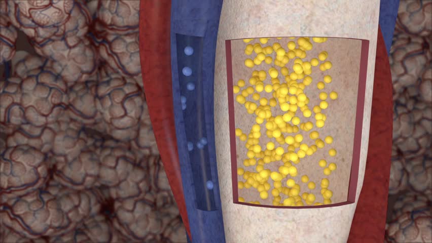 Header of Alveolar