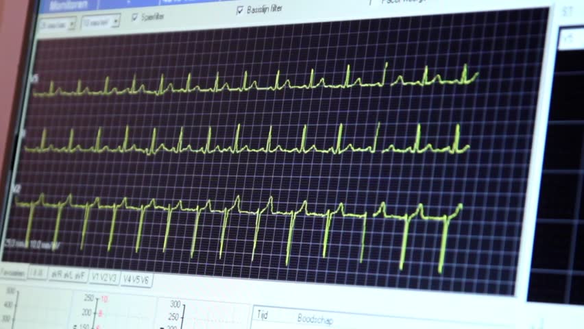 ECG heart rate monitor