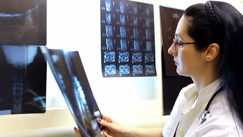 Radiology ; doctor radiologist review X-ray images,video clip