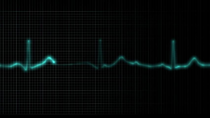 Cardiogram