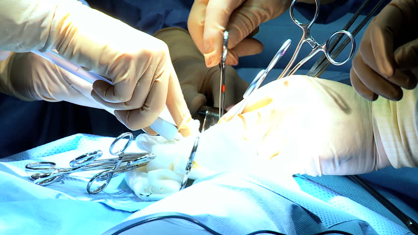 Close up hands wearing surgical gloves operating team protective clothing performing surgery using sterilized equipment