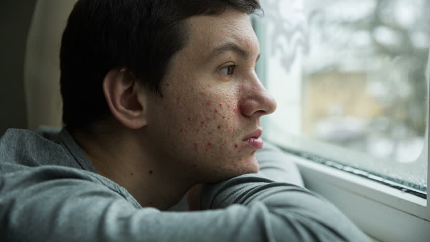acne återförsäljare online acne återförsäljare online