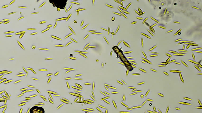 Stock Video Clip of Microscopic Algae Stream 400x (HD). Microscopic ...