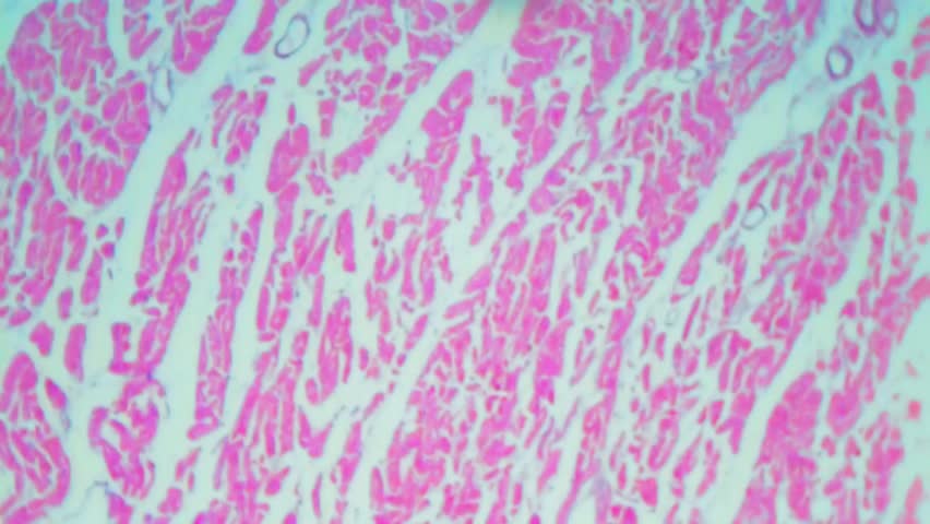 Header of myocardium