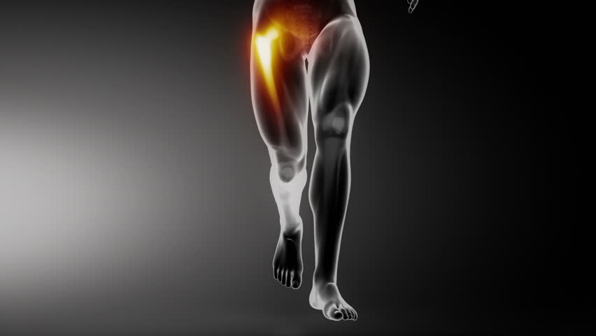Header of anterior