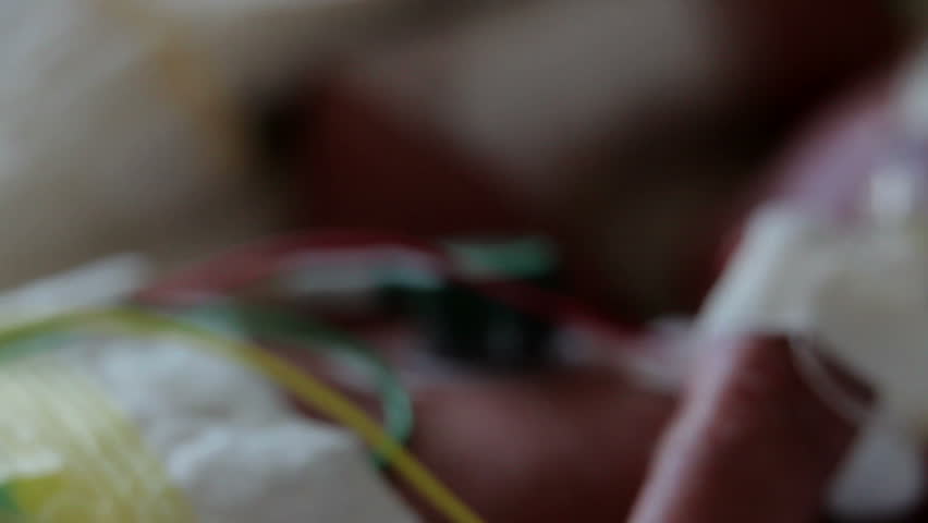 Header of preemie