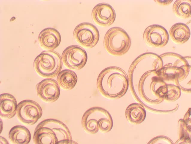 Pinworm Stock Footage Video Shutterstock