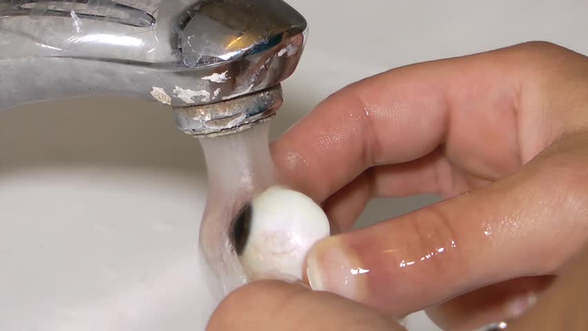 Washing Glass Eye Prosthesis Medical Video.