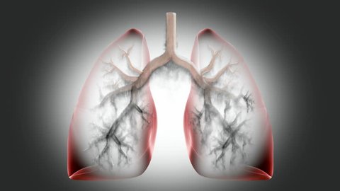 Animated Smoke Traveling Inside Lungs Stock Footage Video (100%  Royalty-free) 9523136 | Shutterstock